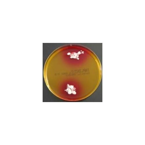 OXOID Dermatophyten-Selektiv-Agar Nährboden AP 10 nach Taplin, Fertigplatten