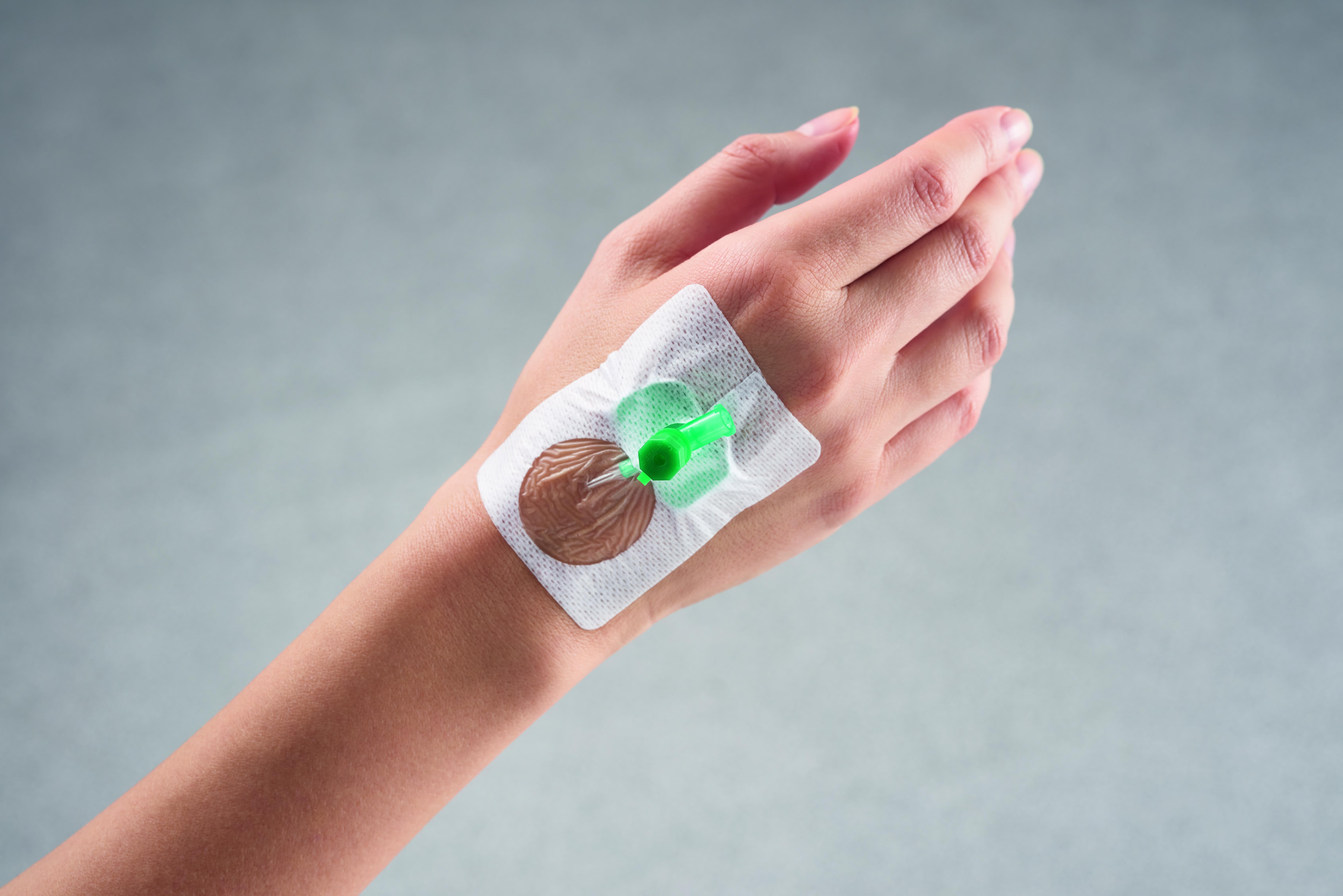 Curafix i.v. Control Kanülenfixierung steril, 6x7,5cm, 50 Stück