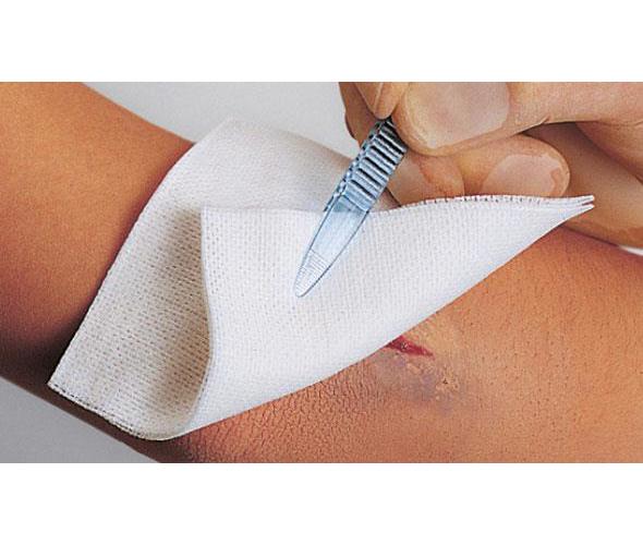 Smith & Nephew Medical Ltd Melolin 10cmx10cm AP 10 steril, Vliesstoffwundaufl. - Bild 3