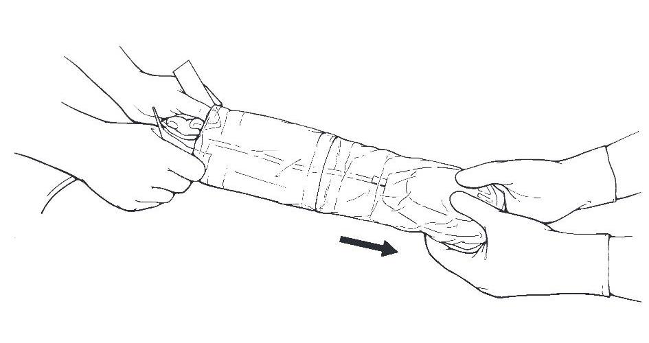 Medtronic sterile Hülle AP 10 für 2090/9790 Programmierkopf