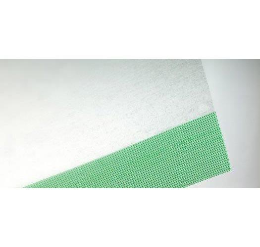 Opsite Inzisionsfolie 10cmx14cm AP 50 transparente PU-Folie, steril