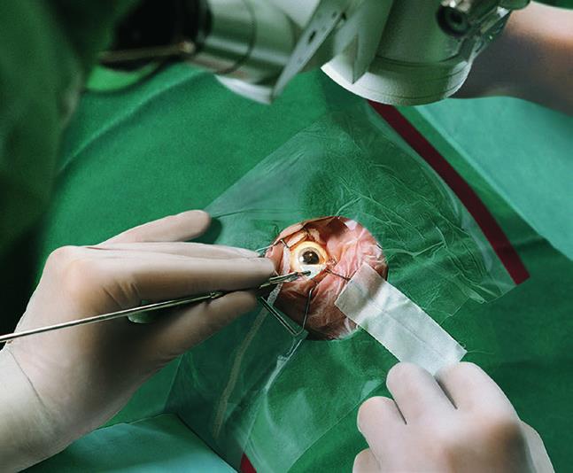 Pro-ophta Keiltupfer, steril 10 Stk eingesiegelt, 50 Stück