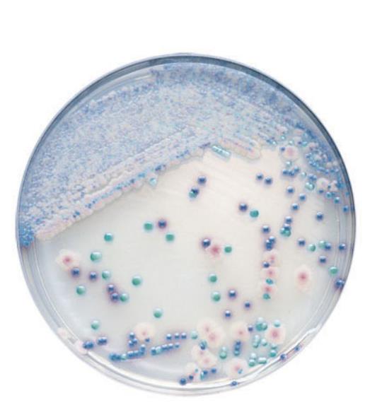 CHROMagar Candida Medium AP 20 gebrauchsfertige Nährmedien
