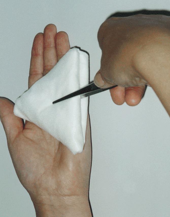 Fes-Tupf Nr. 15 pflaumengroß unst. AP 500 dreieckige Form