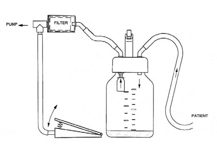 ARDO MEDICAL Hydrophober-Bakterienfilter PK 10 0,33µ