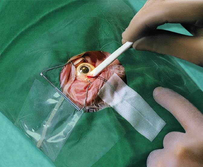 Pro-ophta Stäbchen 5x64mm, 500 Stück