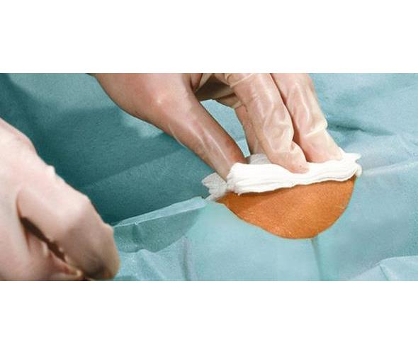 Foliodrape Protect Lochtuch AP 25 150x120cm, Ø 7cm, sk