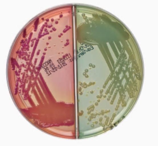 CLED-Agar/MacConkey-Agar Nr. 3 AP 10 90mm-Doppelplatte