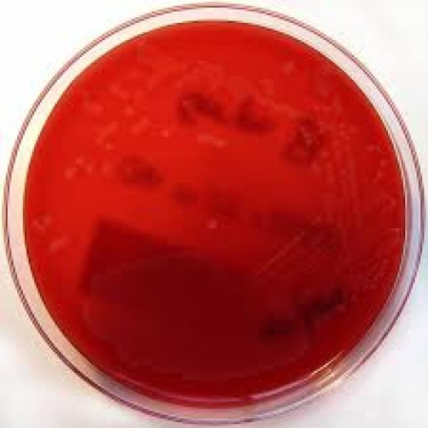BECTON DICKINSON AND COMPANY Columbia-Agar mit 5% Schafblut AP 20 Nachweis d. Hämolysereaktion