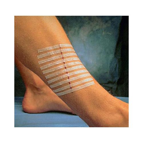 3M Company Steri-Strip 6,0 x 38,0 mm AP 50 Umschläge á 6 Streifen