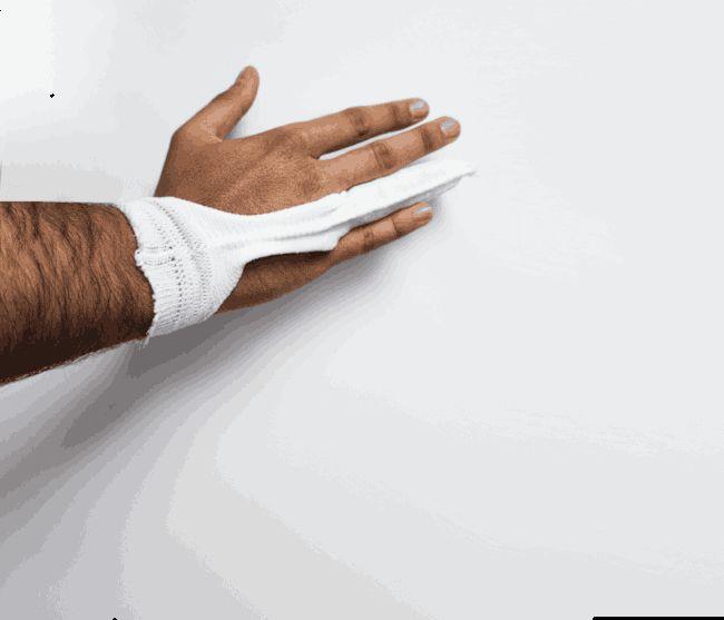 Carefix Finger-u. Zehenverband klein PK 35 gelb