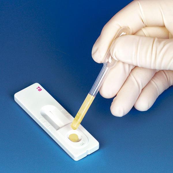 Cleartest Tuberkulose AP 5 Immuno-Assaytest