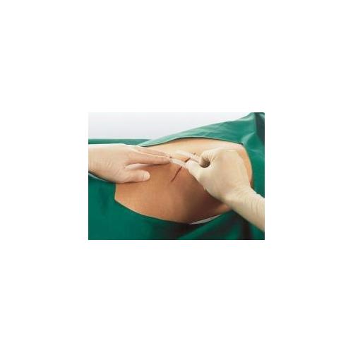 Smith & Nephew Medical Ltd Leukostrip S 76mm x 6,4mm AP 50 à 3 Wundnahtstreifen,hautfarb