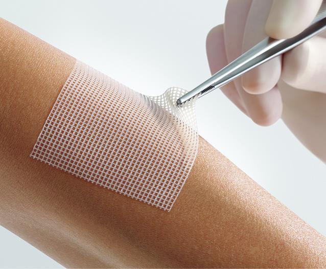 Lomatuell Pro gelbildendes Kontaktnetz , steril, 15x20cm, 5 Stück