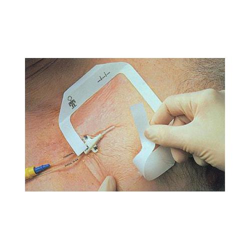 3M Company Tegaderm Film ster. Transparentverband AP 5 6,0 x 7,0 cm