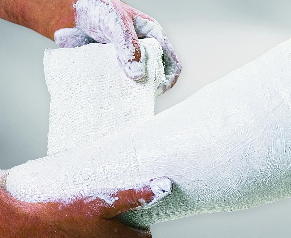 Cellona Gipsbinde 20cmx3m, 30 Stk.