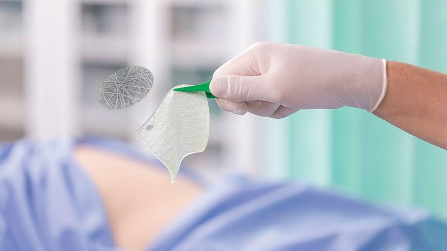 Exufiber Tamponade 1x45cm steril PK 5 gelbildender Faserverband