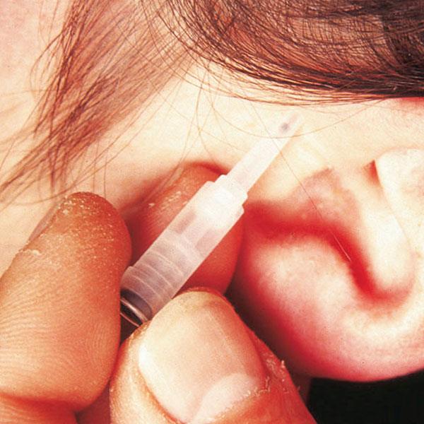 ASP Ohr-Akupunkturnadel AP 200 steril, incl. Pflasterstr.