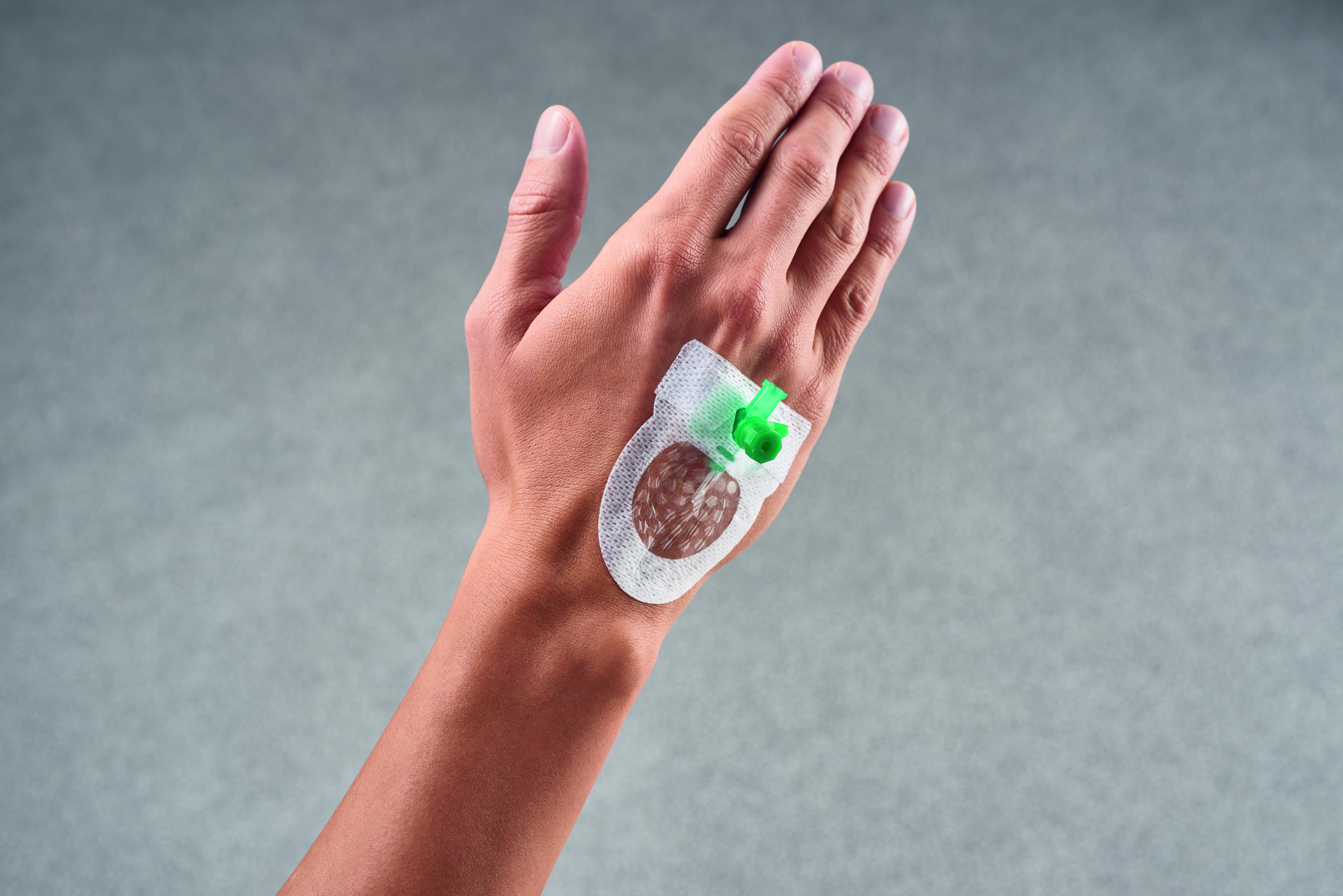 Curafix i.v. Control Kanülenfixierung steril, 5,5x6,5cm, 100 Stück