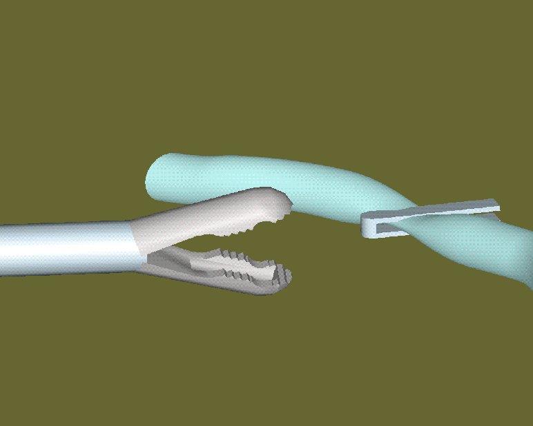 Ligamax Multiclip Applikator 5mm AP 3 Endo Clip