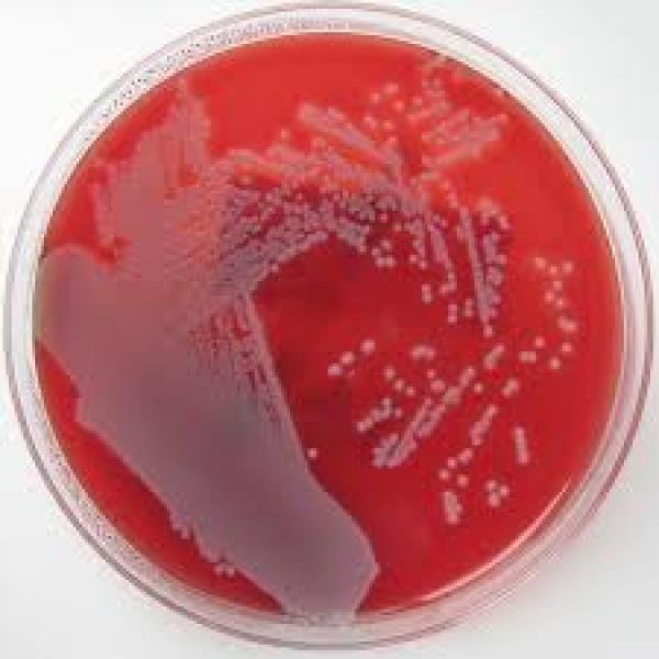 BECTON DICKINSON AND COMPANY MacConkey II Agar AP 20 Nachweis Enterobacteriaceae