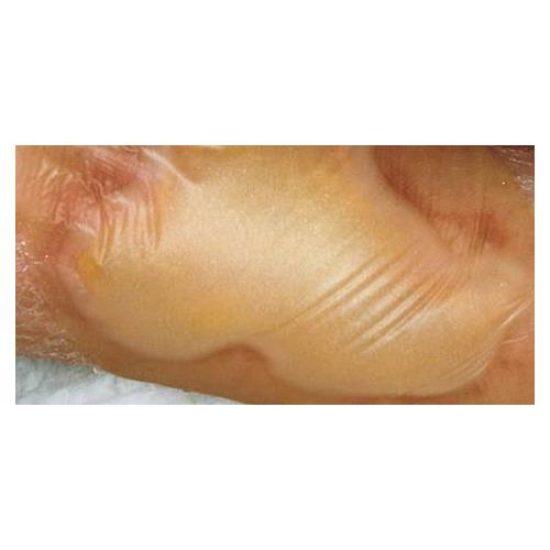 Winner Medical Co., Ltd. Hydrocoll Classic 20 x 20cm selbsthaft. AP 5 Hydrokolloid-Verband