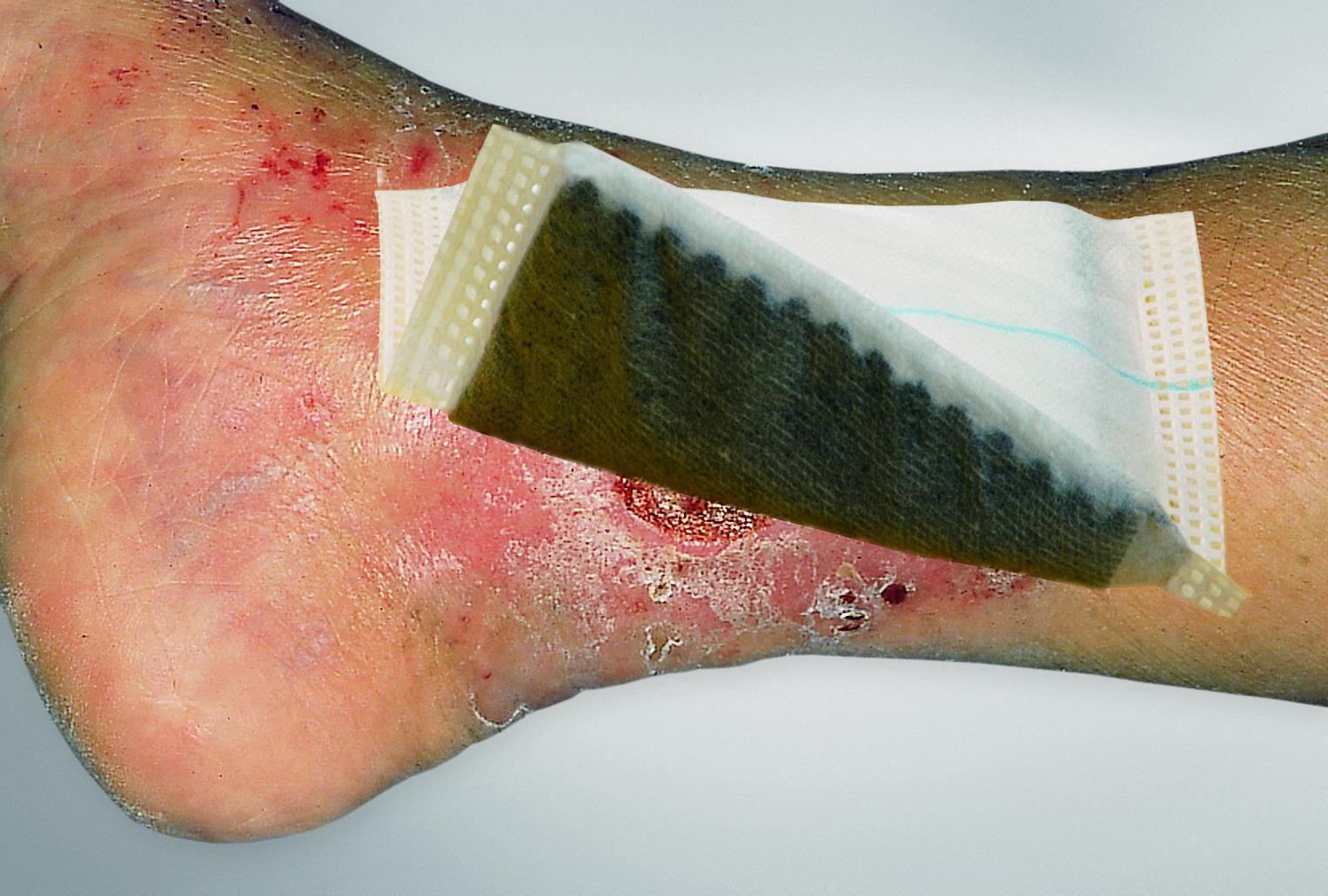 Vliwaktiv Ag Aktivkohle-Tamp. mit Silber steril, 10x10cm, 10 Stück